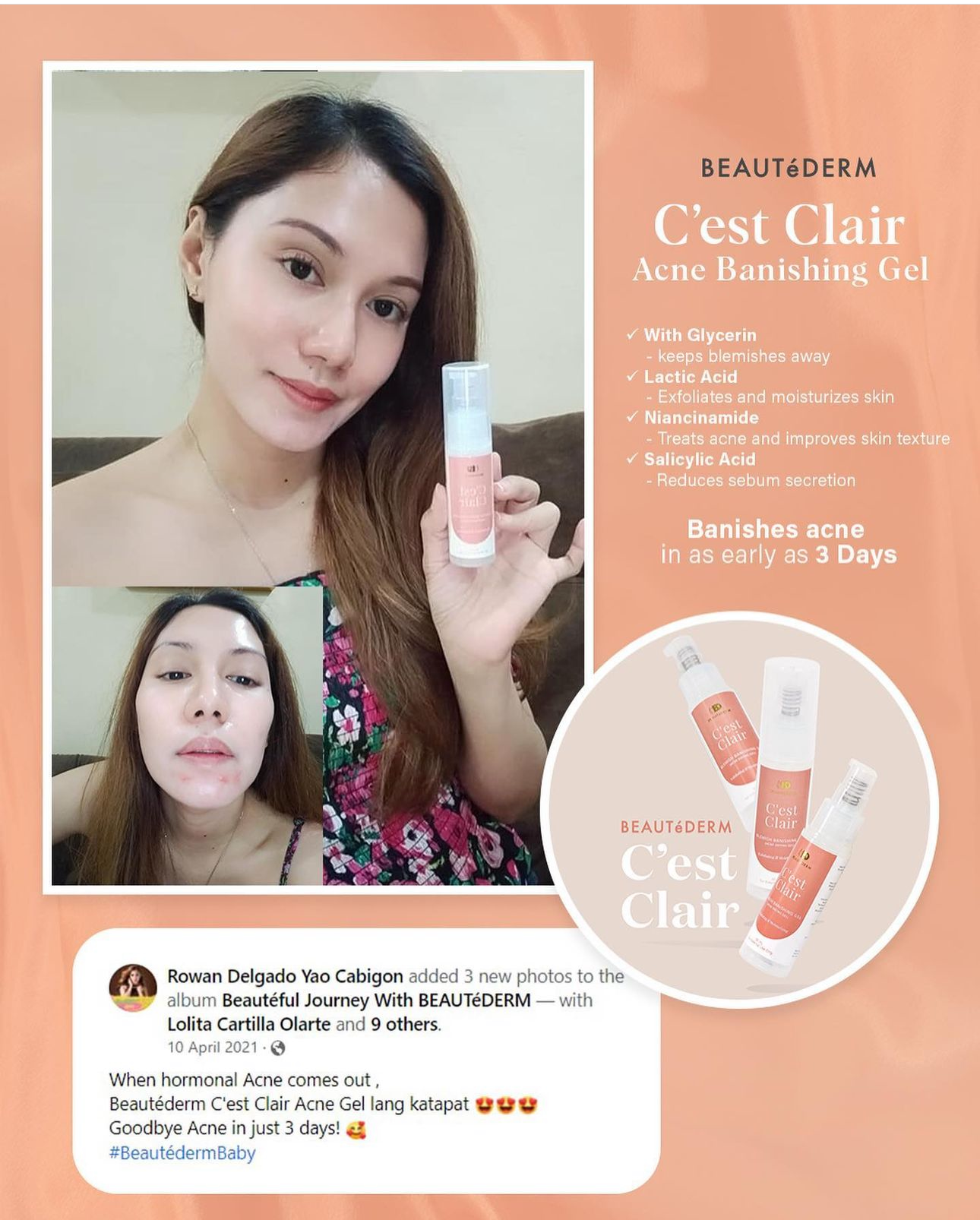 C'est Clair Blemish Banishing Gel (30ml) testimonial by happy customer 