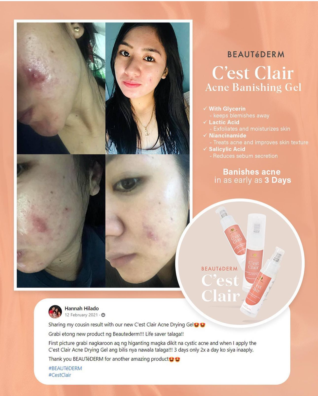 C'est Clair Blemish Banishing Gel (30ml) results 