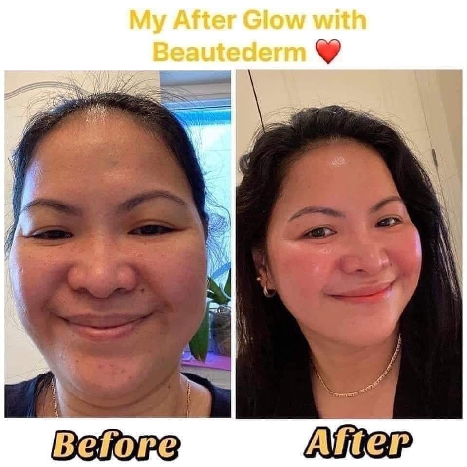 Customer picture which shows customer 's radiant and glowing face after use of beautederm products