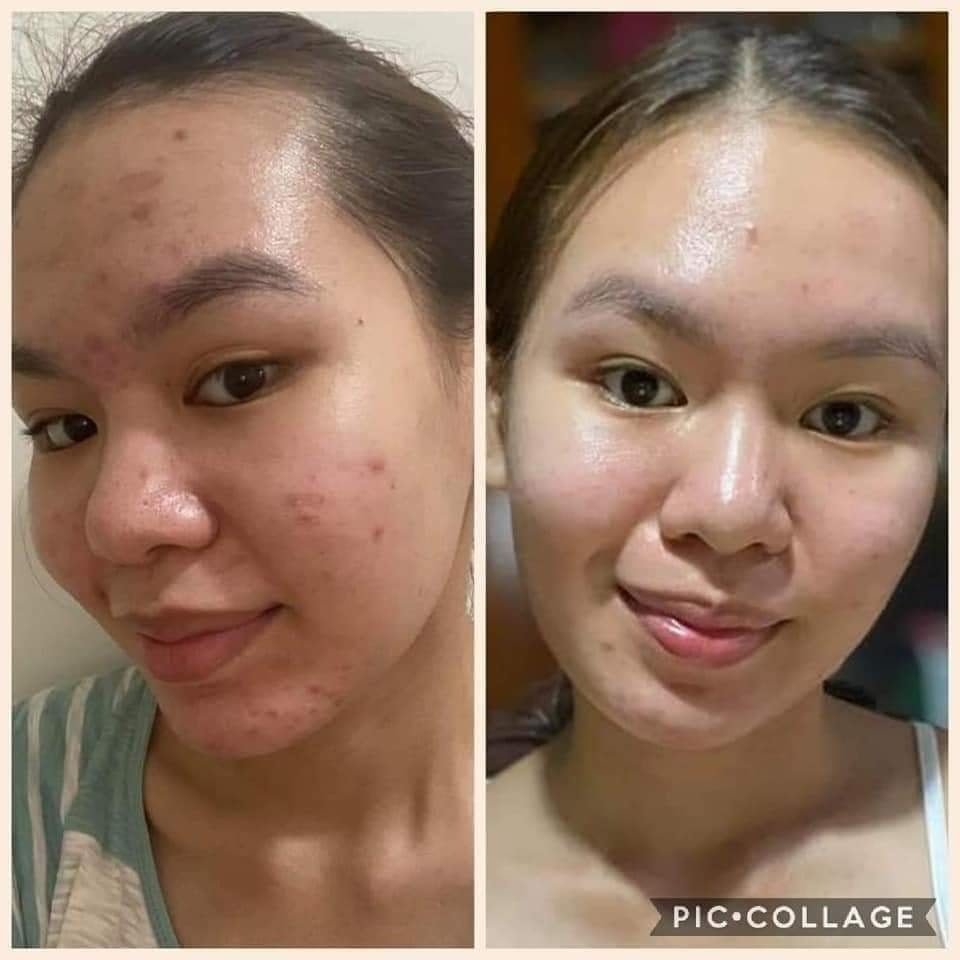 Beautederm testimonial